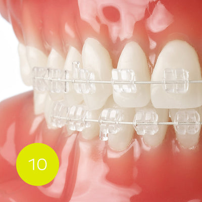Micro-coated NiTi archwires, Round pack 10